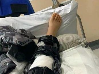 膝盖手术游戏攻略（用游戏攻略恢复膝盖健康，享受无限可能）